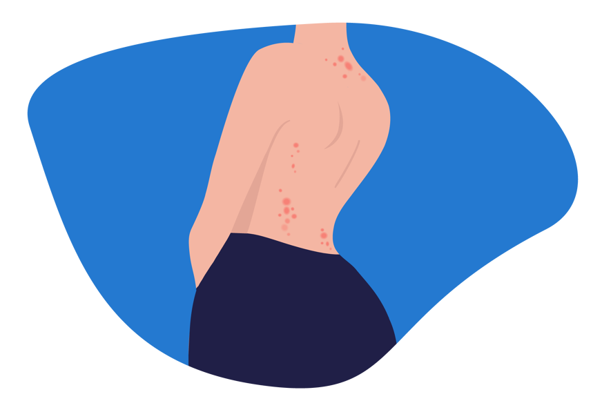 skin reaction